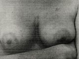 an old black and white photo of a woman ' s breast