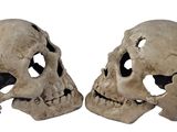 deux crânes humains sur fond blanc