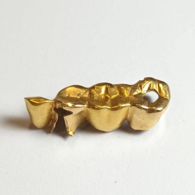 une dent plaquée or dans laquelle est enfoncée une brosse à dents