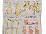 an image of a diagram of the different types of bones
