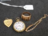 several pieces of jewelry including a watch, bracelet, ring, and ring