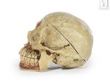 a human skull with a broken jaw on a white surface
