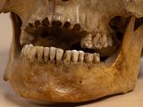 a close up of a human skull on a table