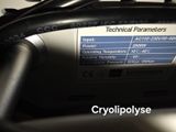 a close up view of a motorcycle ' s engine