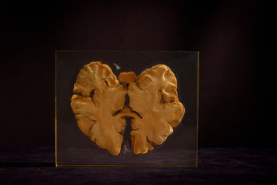 une image représentant un cerveau humain dans une boîte en verre posée sur une table