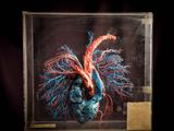 an image of a model of a human heart in a glass case