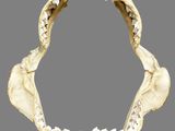 a close up of a tooth with a missing jaw on a gray background