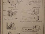 diagram of a person ' s eye and other parts of the eye