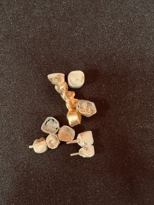 quelques petits coquillages sont posés sur une surface noire