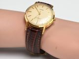 une photo du poignet d'une femme portant une montre