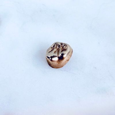 une photo d'une dent dans la neige