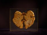 a picture of a human brain in a glass box