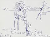 dessin représentant un homme avec une jambe et un bras cassés