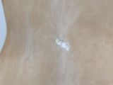 a white substance on the back of a woman ' s body