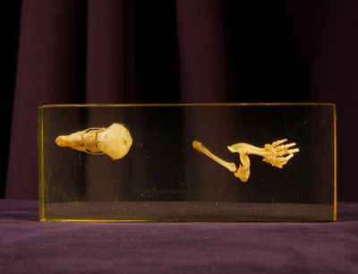 une boîte en verre sur laquelle figurent l'image d'un squelette et d'une main humaine