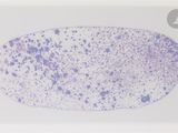 une image d'une cellule recouverte de nombreux points bleus