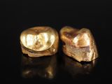 une paire de dents en or sur un fond noir