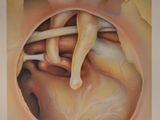 an image of a drawing of a heart with a needle in it