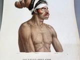 an old print of a man with a headband and a bandage on his face
