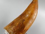a large tooth that is on a clear stand