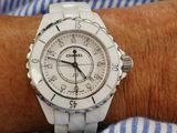 a close up of a person ' s wrist with a watch on it