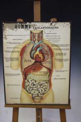 une image représentant un chevalet en bois sur lequel figure un schéma du corps humain