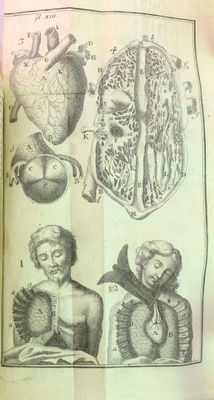 un vieux livre sur lequel figurent des dessins d'organes humains