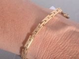 a close up of a person ' s arm with a gold bracelet