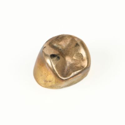 Or dentaire. 2,5 g brut - Photo 1