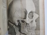 an open book with a drawing of a human skull on it