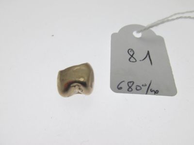 couronne dentaire or bas-titre 680°/°° (reste de ciment), … - Photo 1