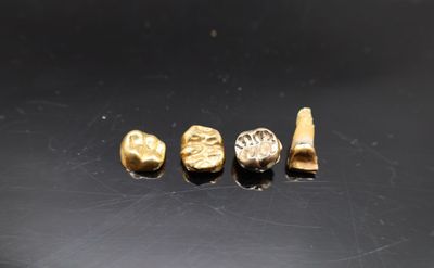 un gros plan sur une dent, une brosse à dents et d'autres objets posés sur une table