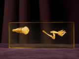a glass box with a picture of a skeleton and a human hand