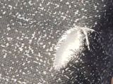 a black and white photo of a person ' s arm with a white substance on it