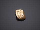 an image of a gold tooth on a black surface