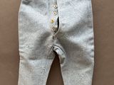 un gros plan sur un pantalon muni de boutons