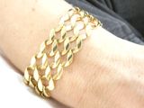 a close up of a person ' s arm with a gold bracelet