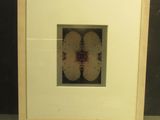 une photo d'une image représentant un cerveau humain, encadrée