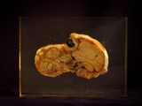 a picture of a human skull in a glass box