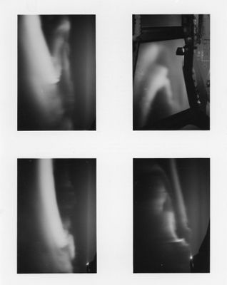 quatre photographies en noir et blanc représentant le bras et les jambes d'une personne