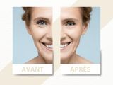 two photos of a woman ' s face before and after rejuicing