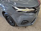 the front end of a grey car with a denting dent on it