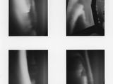 quatre photographies en noir et blanc représentant le bras et les jambes d'une personne