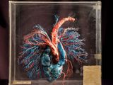 a close up of a model of a human heart in a glass case