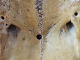 a close up of a skull with a hole in it