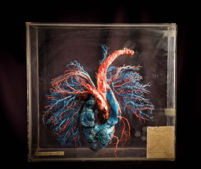 une image représentant une maquette de cœur humain dans une vitrine