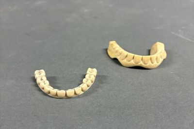 two teeth that have been placed next to each other