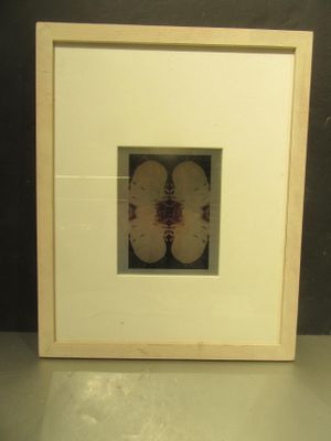 une photo d'une image représentant un cerveau humain, encadrée