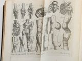 an open book with a drawing of human anatomy on it