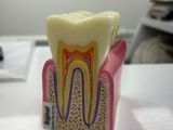 a tooth model sitting on a table in front of a tv
